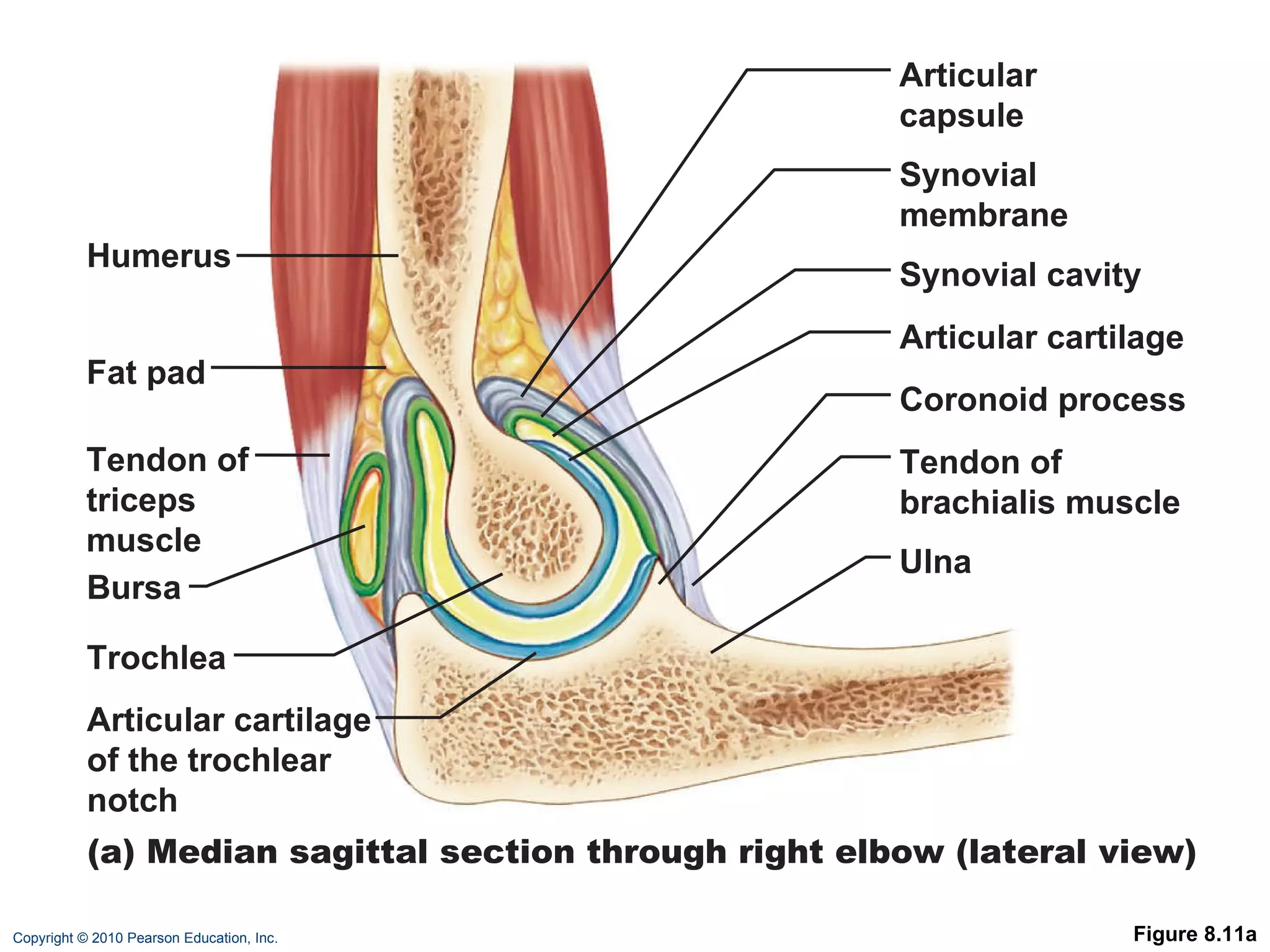 Figure 8.11a Articular capsule Synovial membrane Synovial cavity Articular cartilage Coronoid process Tendon of brachialis muscle Ulna Humerus Fat pad Tendon of triceps muscle Bursa Trochlea Articular cartilage of the trochlear notch (a) Median sagittal section through right elbow (lateral view) 