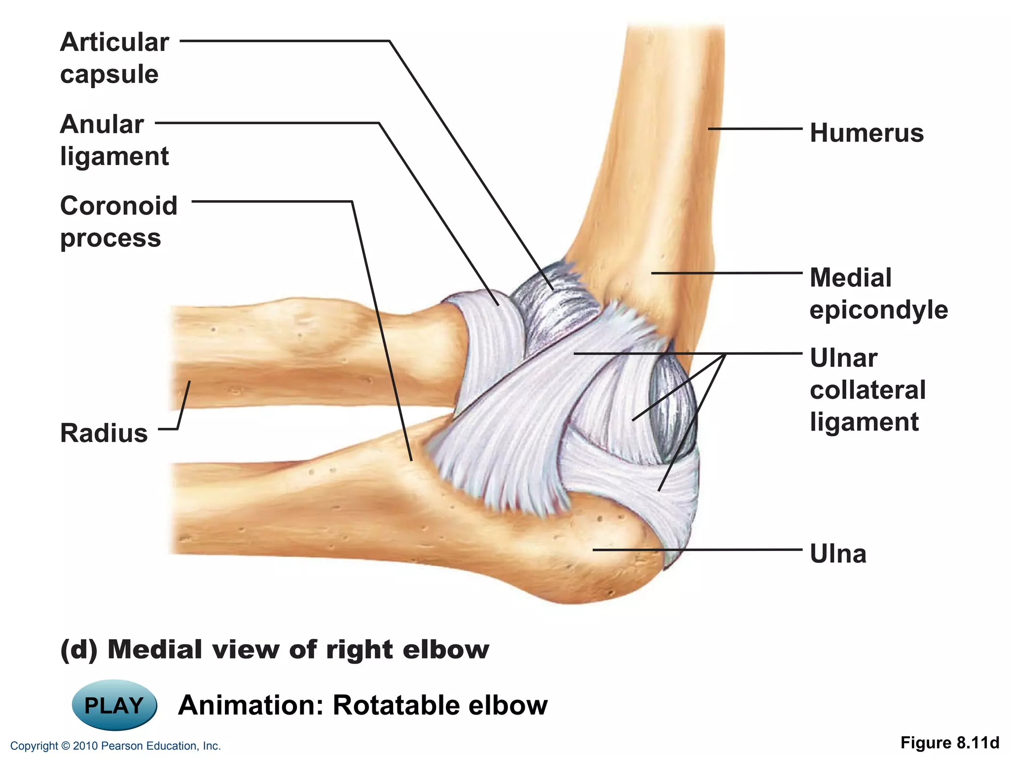 PLAY Animation: Rotatable elbow Figure 8.11d Articular capsule Anular ligament Coronoid process (d) Medial view of right elbow Radius Humerus Medial epicondyle Ulnar collateral ligament Ulna 