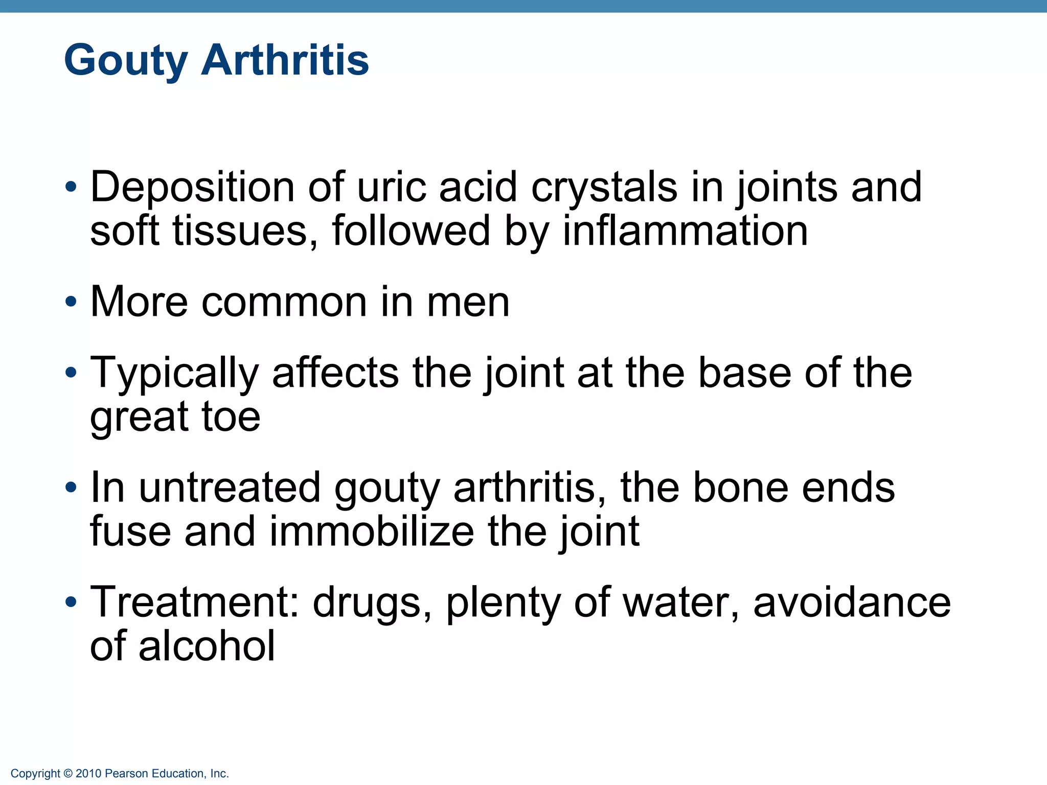 Gouty Arthritis Deposition of uric acid crystals in joints and soft tissues, followed by inflammation More common in men  Typically affects the joint at the base of the great toe In untreated gouty arthritis, the bone ends fuse and immobilize the joint Treatment: drugs, plenty of water, avoidance of alcohol 