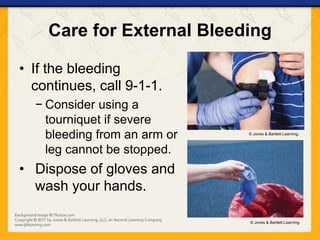 Ch08 presentation bleeding | PPTX