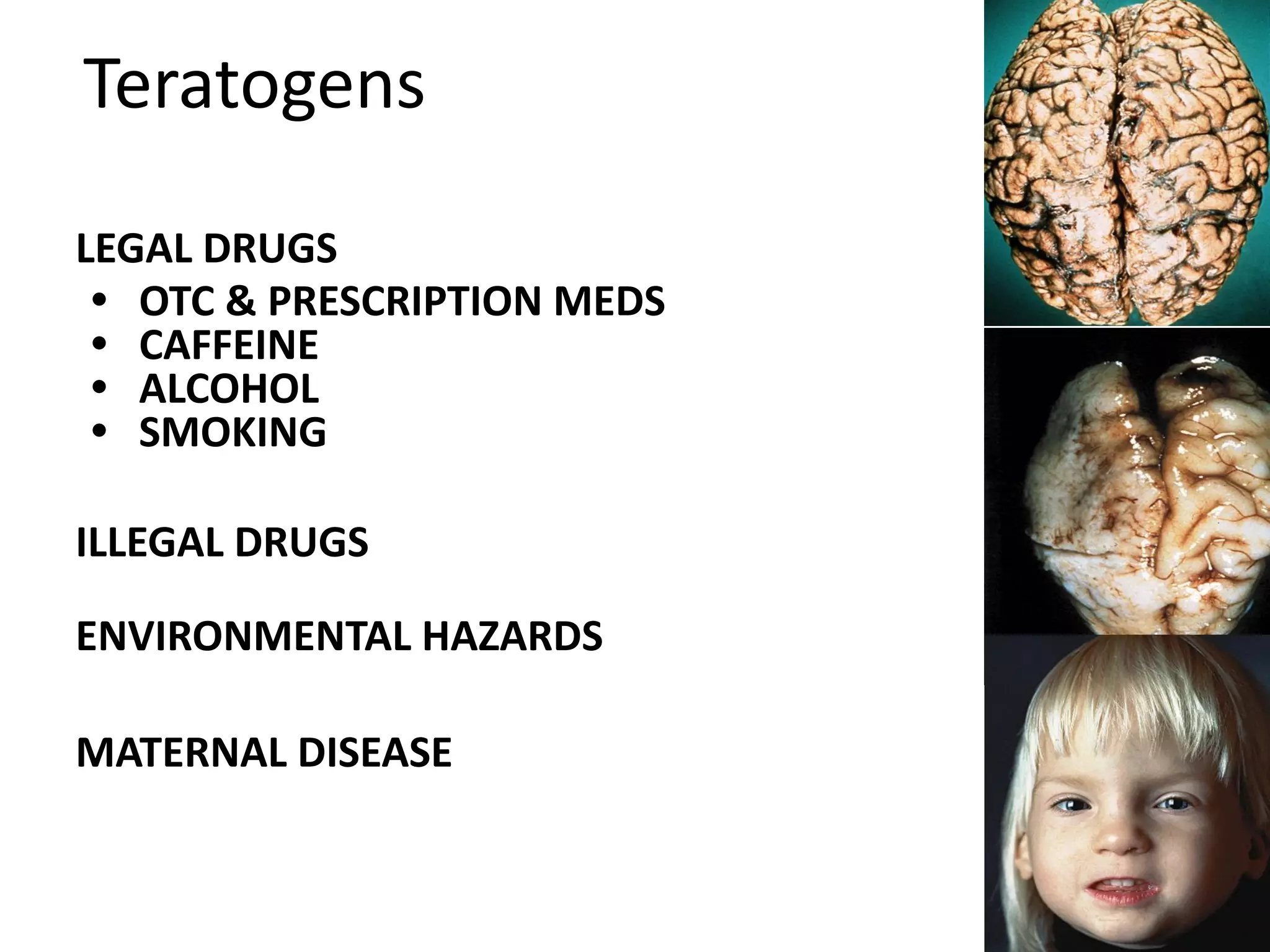 Teratogens
9
LEGAL DRUGS
• OTC & PRESCRIPTION MEDS
• CAFFEINE
• ALCOHOL
• SMOKING
ILLEGAL DRUGS
ENVIRONMENTAL HAZARDS
MATERNAL DISEASE
 