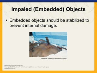 Ch09 presentation wounds | PPTX