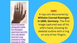 The History of Diagnostic Medical imaging | PDF