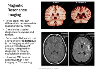 Magnetic
Resonance
Imaging
• In the brain, MRI can
differentiate between white
matter and grey matter
• Can also be used to
diagnose aneurysms and
tumors.
• Because MRI does not use
x-rays or other radiation, it
is the imaging modality of
choice when frequent
imaging is required for
diagnosis or therapy,
especially in the brain.
• However, MRI is more
expensive than x-ray
imaging or CT scanning.
Dr. Sujata P. Pathak, IT, KJSSE
 