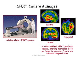 SPECT Camera & Images
sagittal
transaxial
rotating planar SPECT camera
coronal
Tc-99m HMPAO SPECT perfusion
images, showing decreased blood
perfusion to posterior frontal and
anterior temporal lobes
Dr. Sujata P. Pathak, IT, KJSSE
 