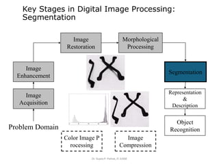 Key Stages in Digital Image Processing:
Segmentation
Dr. Sujata P. Pathak, IT, KJSSE
Image
Acquisition
Image
Restoration
Morphological
Processing
Segmentation
Object
Recognition
Image
Enhancement
Representation
&
Description
Problem Domain
Color Image P
rocessing
Image
Compression
 