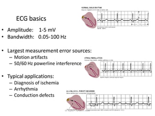 ECG basics
• Amplitude: 1-5 mV
• Bandwidth: 0.05-100 Hz
• Largest measurement error sources:
– Motion artifacts
– 50/60 Hz powerline interference
• Typical applications:
– Diagnosis of ischemia
– Arrhythmia
– Conduction defects
Dr. Sujata P. Pathak, IT, KJSSE
 