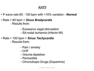 RATE
• P wave rate 60 - 100 bpm with <10% variation - Normal
• Rate < 60 bpm = Sinus Bradycardia
- Results from:
- Excessive vagal stimulation
- SA nodal ischemia (Inferior MI)
• Rate > 100 bpm = Sinus Tachycardia
- Results from:
- Pain / anxiety
- CHF
- Volume depletion
- Pericarditis
- Chronotropic Drugs (Dopamine)
Dr. Sujata P. Pathak, IT, KJSSE
 