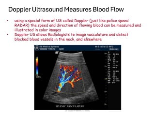 Doppler Ultrasound Measures Blood Flow
• using a special form of US called Doppler (just like police speed
RADAR) the speed and direction of flowing blood can be measured and
illustrated in color images
• Doppler US allows Radiologists to image vasculature and detect
blocked blood vessels in the neck, and elsewhere
Dr. Sujata P. Pathak, IT, KJSSE
 