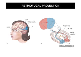 RETINOFUGAL PROJECTION




           LGN
             Optic radiation

                                  R optic tract
retina              V1
                                          R LGN

                                                R optic
                                                radiation




                                           V1
 