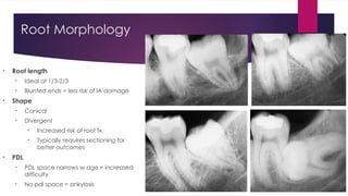 Principles of Management of Impacted Teeth_Mari-Alina_Timoshchuk.pptx