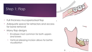 Principles of Management of Impacted Teeth_Mari-Alina_Timoshchuk.pptx