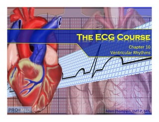 The ECG Course 
Chapter%10% 
Ventricular%Rhythms% 
Adam%Thompson,%EMT/P,%BAS% 
 