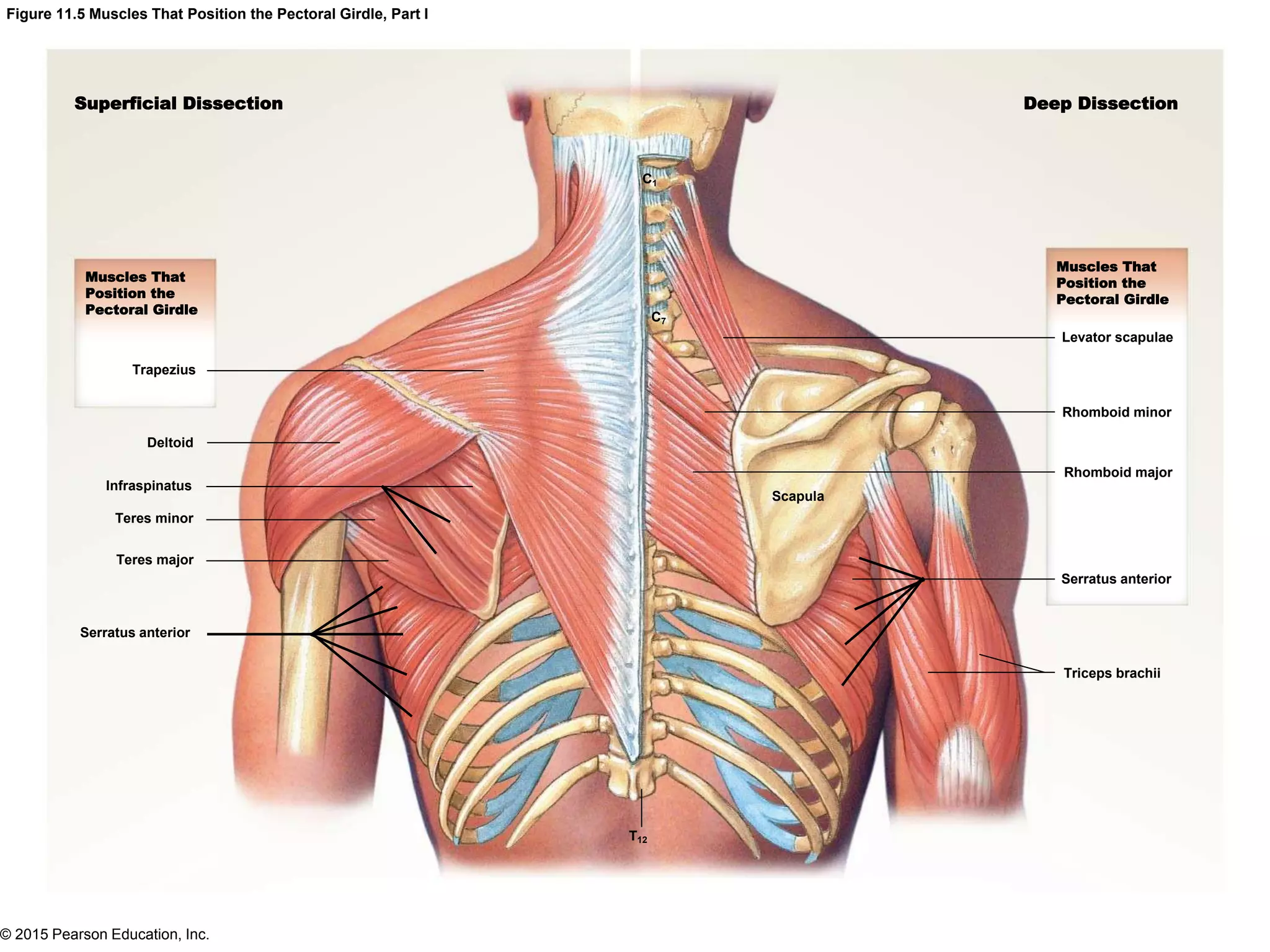 © 2015 Pearson Education, Inc.
Figure 11.5 Muscles That Position the Pectoral Girdle, Part I
Superficial Dissection Deep Dissection
Muscles That
Position the
Pectoral Girdle
Muscles That
Position the
Pectoral Girdle
Levator scapulae
Rhomboid minor
Rhomboid major
Serratus anterior
Triceps brachii
Scapula
C1
C7
Trapezius
Deltoid
Infraspinatus
Teres minor
Teres major
Serratus anterior
T12
 