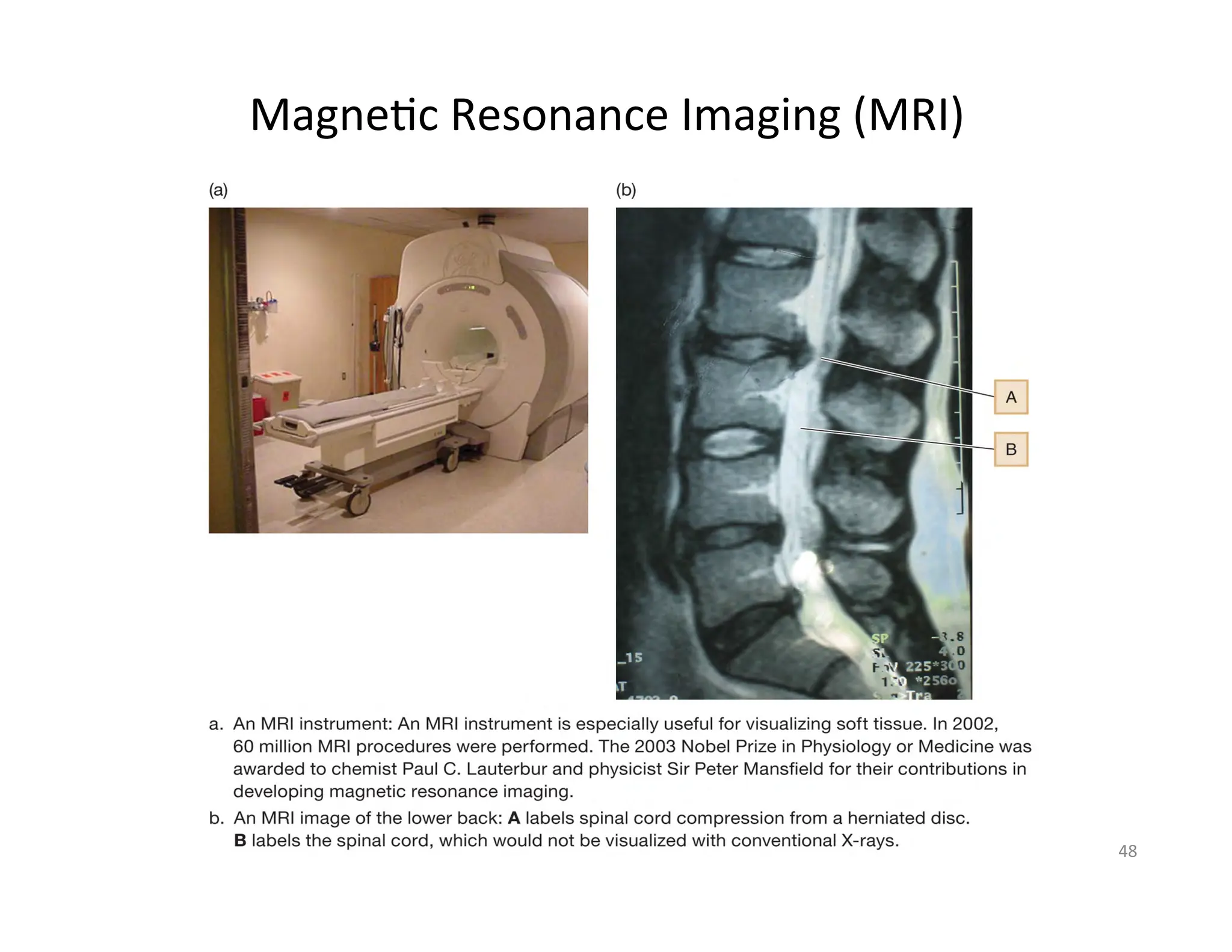 48	
  
Magne=c	
  Resonance	
  Imaging	
  (MRI)	
  
 