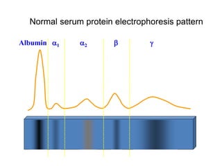 Normal serum protein electrophoresis pattern
+ -
Albumin 1 2  
 