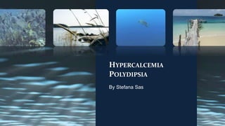 HypercalcemiaPolydipsia By Stefana Sas 