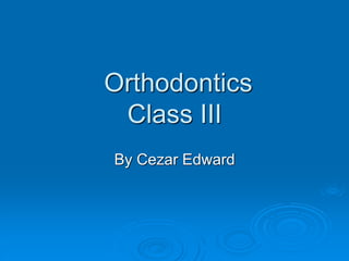 Orthodontics
Class III
By Cezar Edward
 