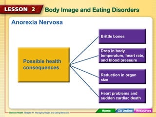 Anorexia Nervosa 
Possible health 
consequences 
Brittle bones 
Drop in body 
temperature, heart rate, 
and blood pressure 
Reduction in organ 
size 
Heart problems and 
sudden cardiac death 
 