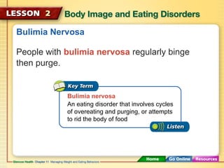 Bulimia Nervosa 
People with bulimia nervosa regularly binge 
then purge. 
Bulimia nervosa 
An eating disorder that involves cycles 
of overeating and purging, or attempts 
to rid the body of food 
 