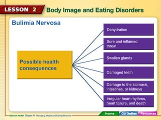 Bulimia Nervosa 
Possible health 
consequences 
Dehydration 
Sore and inflamed 
throat 
Swollen glands 
Damaged teeth 
Damage to the stomach, 
intestines, or kidneys 
Irregular heart rhythms, 
heart failure, and death 
 