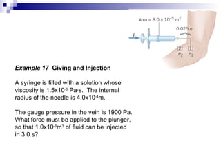 Example 17  Giving and Injection A syringe is filled with a solution whose  viscosity is 1.5x10 -3  Pa ·s.  The internal radius of the needle is 4.0x10 -4 m. The gauge pressure in the vein is 1900 Pa. What force must be applied to the plunger, so that 1.0x10 -6 m 3  of fluid can be injected  in 3.0 s? 