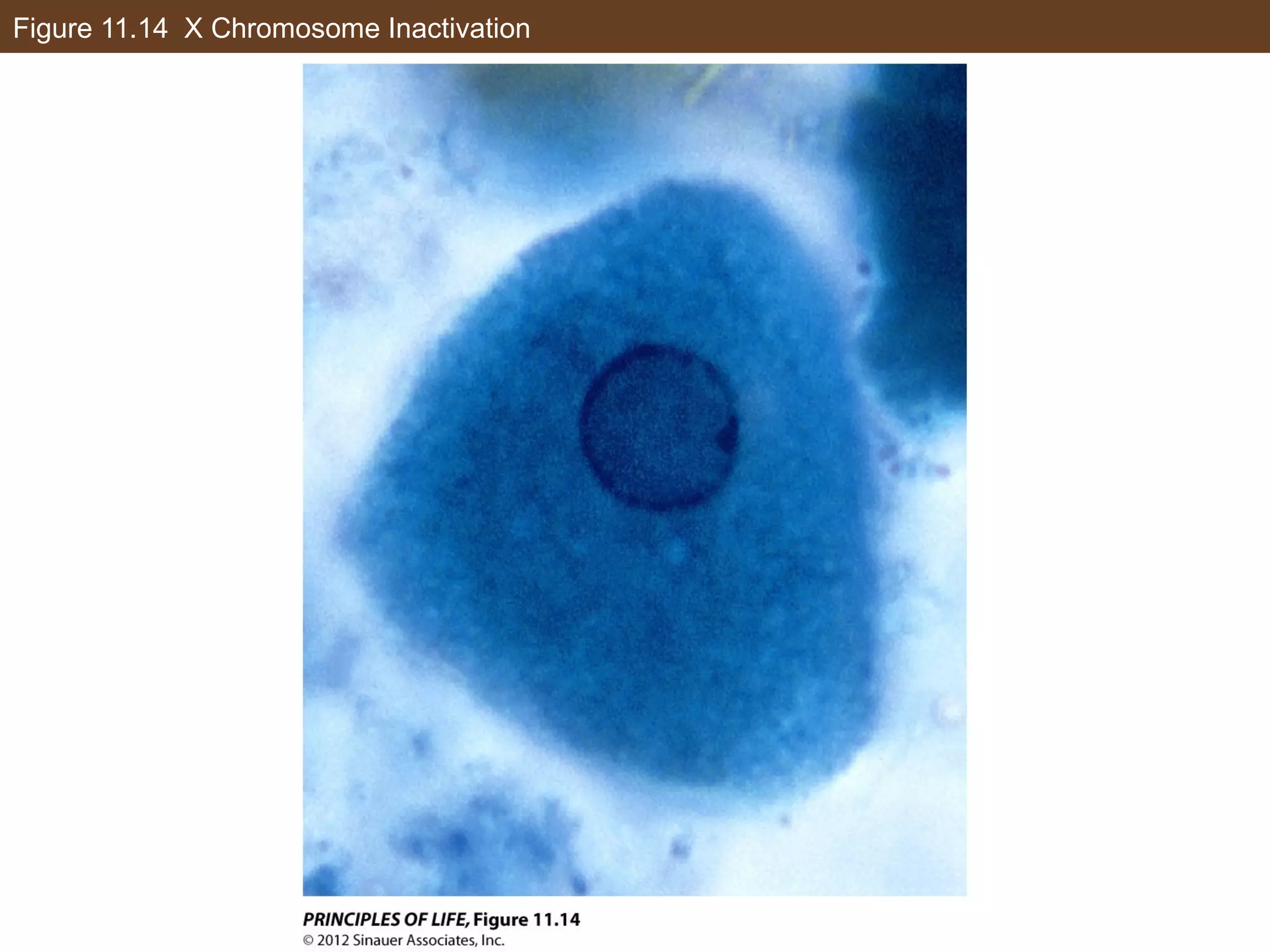 Figure 11.14 X Chromosome Inactivation
 