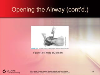 ©2013 Delmar, Cengage Learning. All Rights Reserved. May not be scanned,
copied, duplicated, or posted to a publicly accessible website, in whole or in part.
Opening the Airway (cont’d.)
Figure 12-5: Head-tilt, chin-lift
25
 