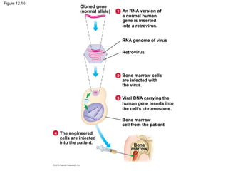Figure 12.10

Cloned gene
(normal allele)

1 An RNA version of

a normal human
gene is inserted
into a retrovirus.

RNA genome of virus
Retrovirus

2 Bone marrow cells

are infected with
the virus.

3 Viral DNA carrying the

human gene inserts into
the cell’s chromosome.
Bone marrow
cell from the patient
4 The engineered

cells are injected
into the patient.

Bone
marrow

 