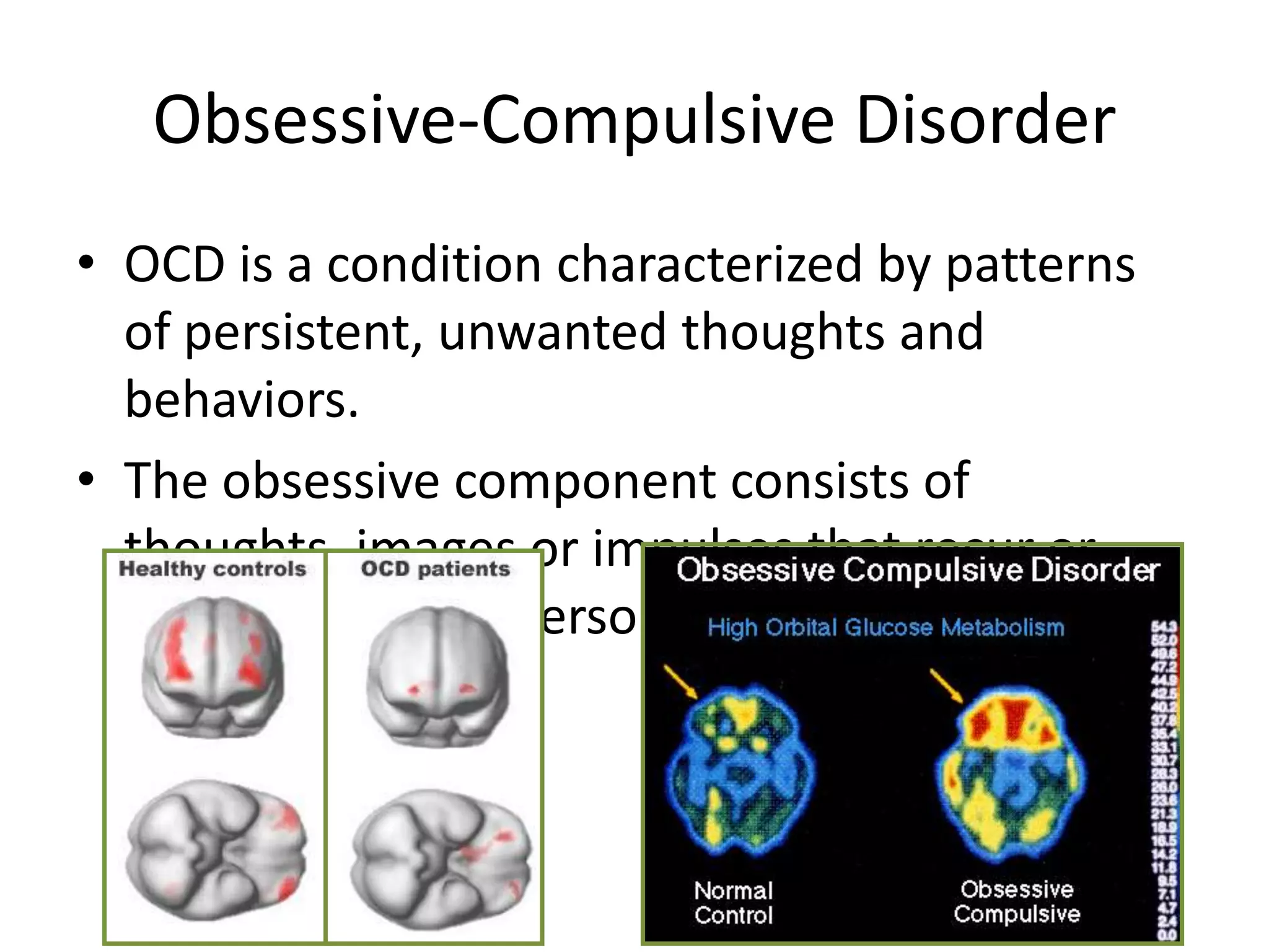 Obsessive-Compulsive Disorder
• OCD is a condition characterized by patterns
of persistent, unwanted thoughts and
behaviors.
• The obsessive component consists of
thoughts, images or impulses that recur or
persist despite a person’s efforts to suppress
them.
 