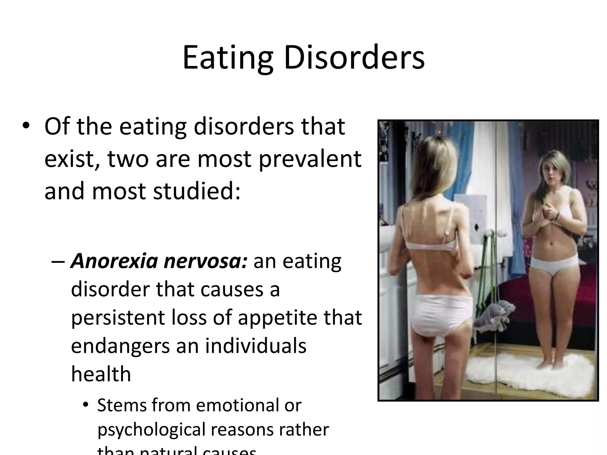 Eating Disorders
• Of the eating disorders that
exist, two are most prevalent
and most studied:
– Anorexia nervosa: an eating
disorder that causes a
persistent loss of appetite that
endangers an individuals
health
• Stems from emotional or
psychological reasons rather
 