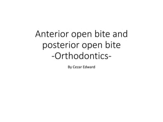 Anterior open bite and
posterior open bite
-Orthodontics-
By Cezar Edward
 