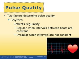 Copyright © 2016, 2012, 2009 by Pearson Education, Inc.
All Rights Reserved
Emergency Care, 13e
Daniel Limmer | Michael F. O'Keefe
Pulse Quality
• Two factors determine pulse quality.
 Rhythm
• Reflects regularity
• Regular when intervals between beats are
constant
• Irregular when intervals are not constant
continued on next slide
 