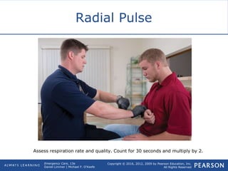Copyright © 2016, 2012, 2009 by Pearson Education, Inc.
All Rights Reserved
Emergency Care, 13e
Daniel Limmer | Michael F. O'Keefe
Radial Pulse
Assess respiration rate and quality. Count for 30 seconds and multiply by 2.
 