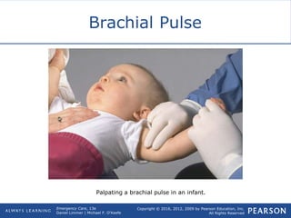 Copyright © 2016, 2012, 2009 by Pearson Education, Inc.
All Rights Reserved
Emergency Care, 13e
Daniel Limmer | Michael F. O'Keefe
Brachial Pulse
Palpating a brachial pulse in an infant.
 