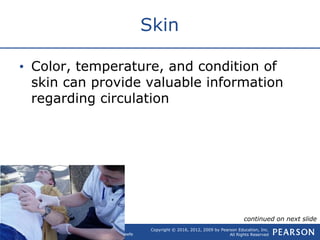 Copyright © 2016, 2012, 2009 by Pearson Education, Inc.
All Rights Reserved
Emergency Care, 13e
Daniel Limmer | Michael F. O'Keefe
Skin
• Color, temperature, and condition of
skin can provide valuable information
regarding circulation
continued on next slide
 