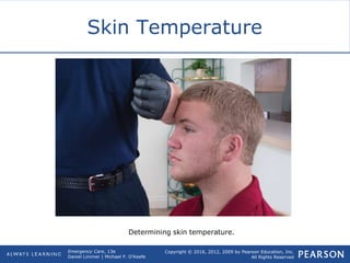 Copyright © 2016, 2012, 2009 by Pearson Education, Inc.
All Rights Reserved
Emergency Care, 13e
Daniel Limmer | Michael F. O'Keefe
Skin Temperature
Determining skin temperature.
 