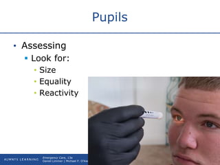Copyright © 2016, 2012, 2009 by Pearson Education, Inc.
All Rights Reserved
Emergency Care, 13e
Daniel Limmer | Michael F. O'Keefe
Pupils
• Assessing
 Look for:
• Size
• Equality
• Reactivity
 
