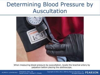 Copyright © 2016, 2012, 2009 by Pearson Education, Inc.
All Rights Reserved
Emergency Care, 13e
Daniel Limmer | Michael F. O'Keefe
Determining Blood Pressure by
Auscultation
When measuring blood pressure by auscultation, locate the brachial artery by
palpation before placing the stethoscope.
 