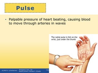 Copyright © 2016, 2012, 2009 by Pearson Education, Inc.
All Rights Reserved
Emergency Care, 13e
Daniel Limmer | Michael F. O'Keefe
Pulse
• Palpable pressure of heart beating, causing blood
to move through arteries in waves
continued on next slide
 