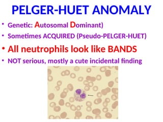 PELGER-HUET ANOMALY
• Genetic: Autosomal Dominant)
• Sometimes ACQUIRED (Pseudo-PELGER-HUET)
• All neutrophils look like BANDS
• NOT serious, mostly a cute incidental finding
 