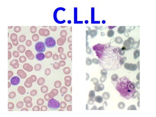 C.L.L.
 