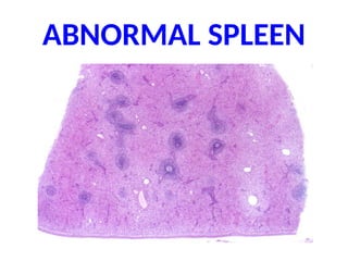 ABNORMAL SPLEEN
 
