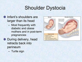 Shoulder Dystocia
Infant’s shoulders are
larger than its head
– Most frequently with
diabetic and obese
mothers and in post-term
pregnancies
During delivery, head
retracts back into
perineum
– Turtle sign
 