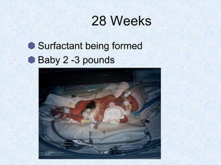 28 Weeks
Surfactant being formed
Baby 2 -3 pounds
 