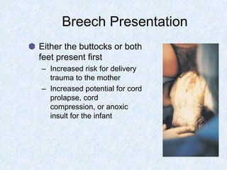 Breech Presentation
Either the buttocks or both
feet present first
– Increased risk for delivery
trauma to the mother
– Increased potential for cord
prolapse, cord
compression, or anoxic
insult for the infant
 