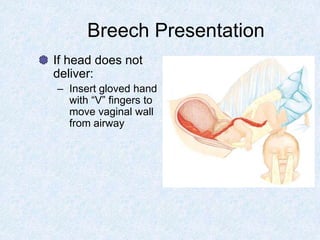 Breech Presentation
If head does not
deliver:
– Insert gloved hand
with “V” fingers to
move vaginal wall
from airway
 