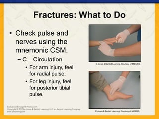 Ch14 presentation bone_joint_muscle_injuries | PPTX