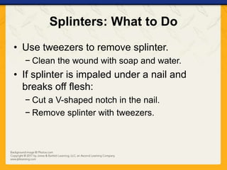 Splinter Usage Ch15 presentation extremity_injuries | PPTX
