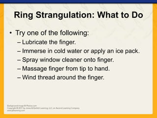 Strangulation Accessory Finger Ch15 presentation extremity_injuries | PPTX